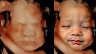 Ecografia emocional amb ia